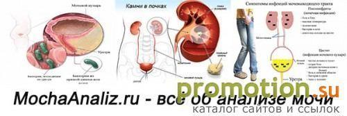 Архивное изображение: MochaAnaliz - всё об анализе мочи