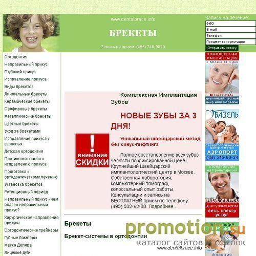 Архивное изображение: Керамические брекеты